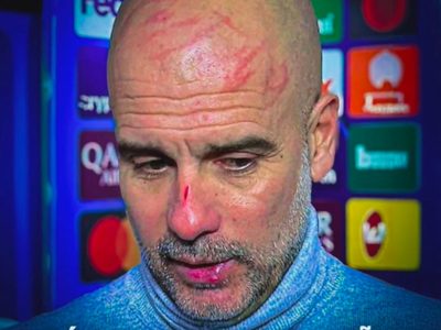 Guardiola se vuelve viral por heridas en el rostro tras empate en Champions: 'Me quería hacer daño'