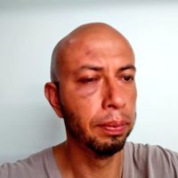 Por agresiones a periodista, la PEDH emite recomendaciones a alcaldes de Guanajuato, León y Silao