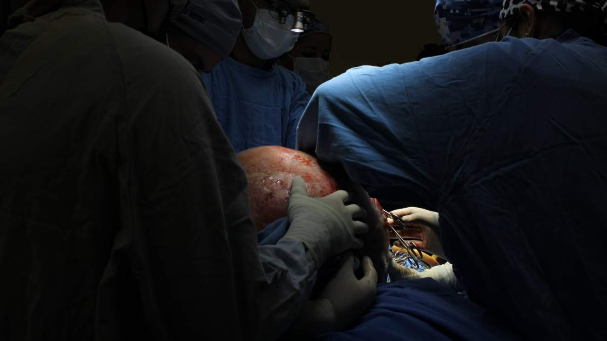 IMSS de Querétaro extirpa tumor ovárico de casi 23 kilogramos a paciente de 37 años