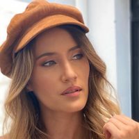 "Tuve que ir a la guardia": Mica Viciconte contó el motivo por el que se le desfiguró el rostro