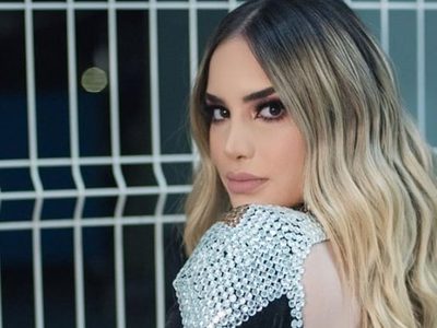 ¿Qué se hizo? El extremo cambio que Kimberly Loaiza se hizo en el rostro con cirugía