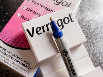 La ANMAT ordenó retirar del mercado del producto Verrugol