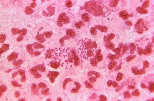 Contagios