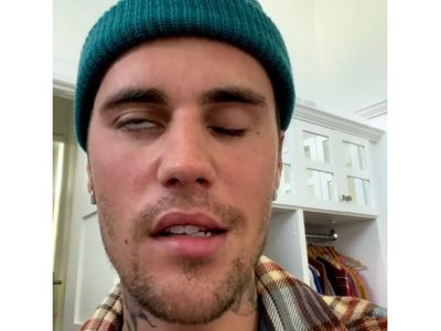 Justin Bieber canceló su gira por un virus que le provocó parálisis facial