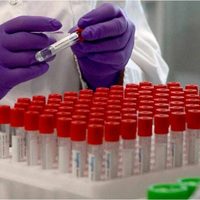 Otorgan un crédito de $30 millones para el desarrollo del suero hiperinmune contra el coronavirus