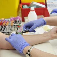 Análisis de sangre predice el riesgo de enfermedad cardiovascular en las mujeres 30 años antes