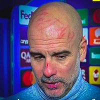 Guardiola se vuelve viral por heridas en el rostro tras empate en Champions: 'Me quería hacer daño'
