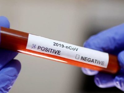 Alerta: una localidad neuquina confirmó su primer caso de coronavirus