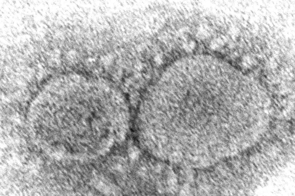 Imagen de microscopio de 2020 proporcionada por los Centros para el Control y la Prevención de Enfermedades de Estados Unidos muestra partículas del virus SARS-CoV-2