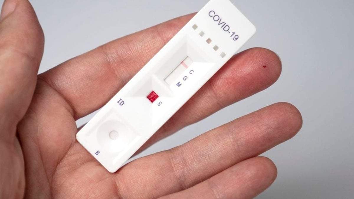 Autotest de coronavirus. Fuente: (Twitter)
