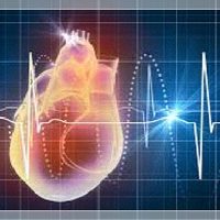 Investigadores de Japón hallan las células inmunitarias que causan infartos potencialmente mortales