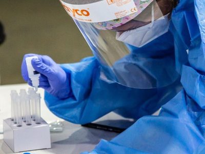 Proyecto Mosaico busca vacuna contra el VIH/SIDA