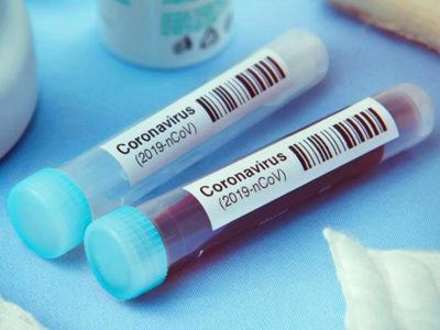 60 nuevos positivos: Neuquén llegó a los 2.200 casos activos de coronavirus
