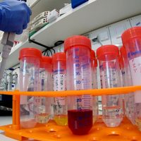 Situación preocupante en La Patagonia: ¡24 casos de coronavirus en un día!