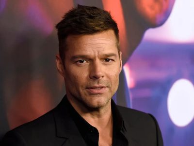 "Nada que esconder": Ricky Martin rompió el silencio y contó la verdad sobre lo ocurrido con su cara
