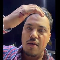 Disparan a ganaderos en intento de asalto sobre la carretera Salamanca-Querétaro (Video)