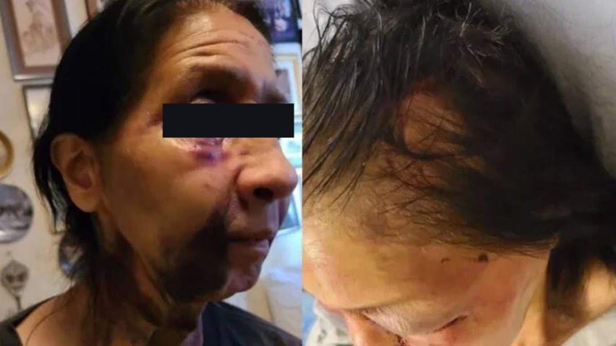 Becky, de 70 años de edad, recibió una golpiza