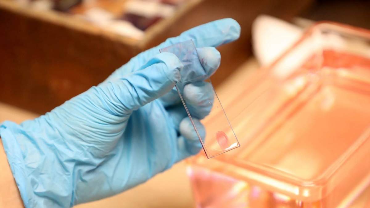 Este martes se celebra el Día Mundial Contra el Cáncer