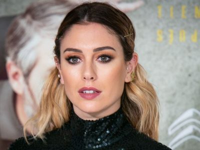 Blanca Suárez confesó su defecto en primer plano: "Uno más arriba que el otro"