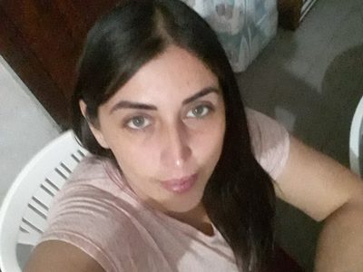Claudia, la mujer que perdió el cartílago de la nariz por una prueba covid