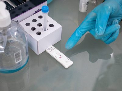 Detectan en Chipre la cepa Deltacrón, que combina las variantes Delta y Ómicron del coronavirus