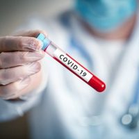 Zapala impactado con los 72 casos positivos de COVID 19 reportados en un solo día