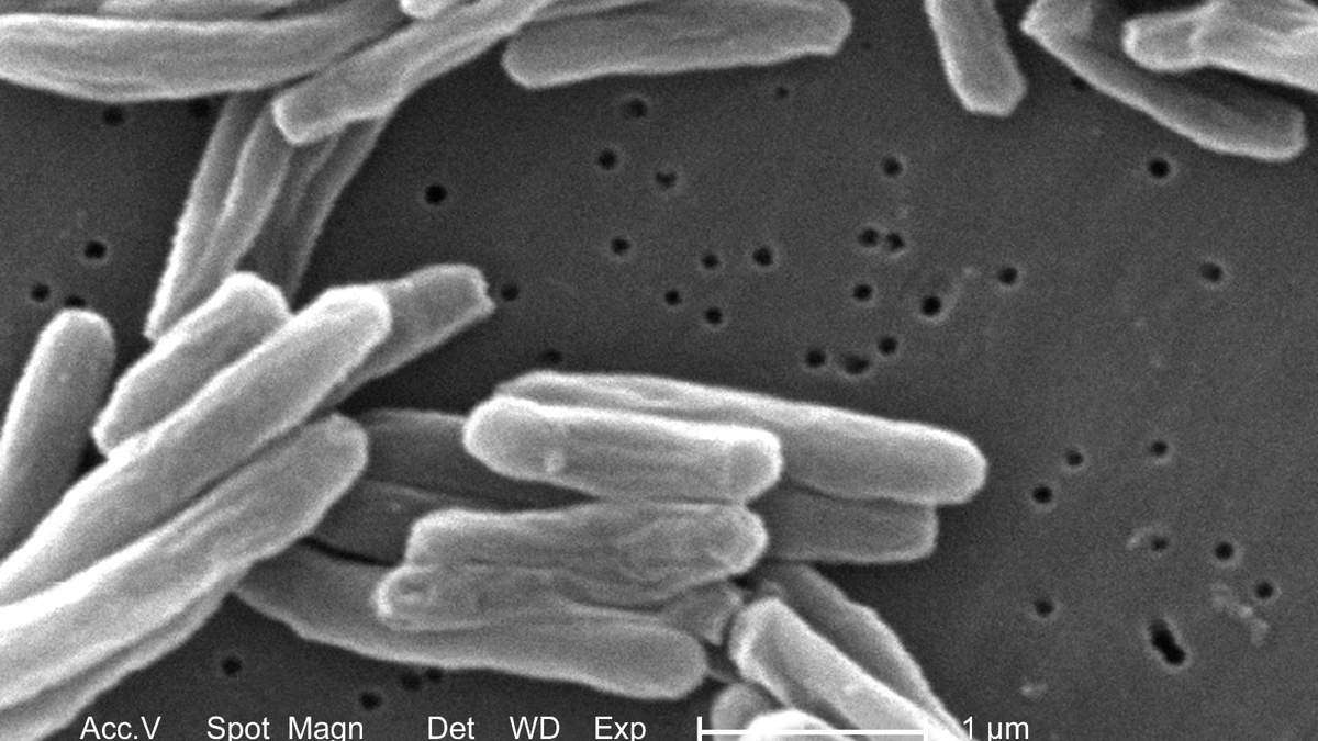 Mycobacterium tuberculosis, bacteria que causa la enfermedad