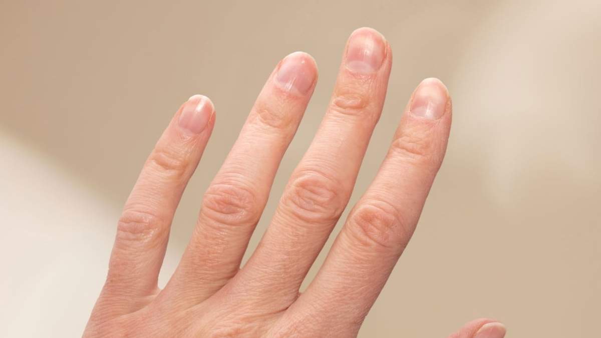 Uñas. Fuente: (X)