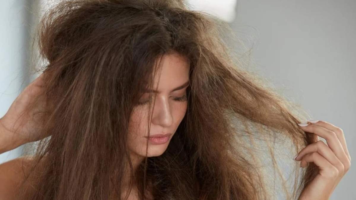 Cabello. Fuente: (X)