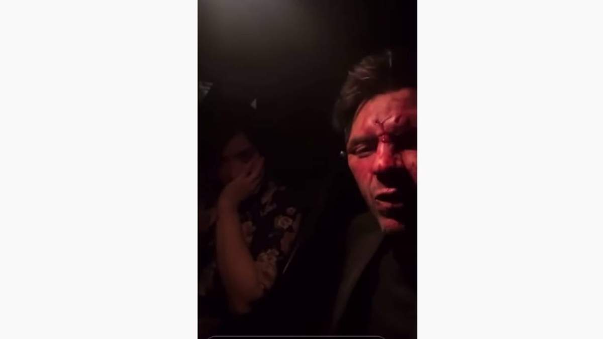 Transmisión en Instagram del músico después de la presunta agresión