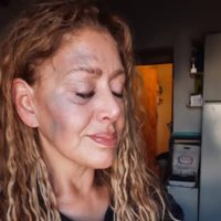 ATE repudió la agresión a una médica en Añelo y reclama seguridad en el hospital y las ambulancias