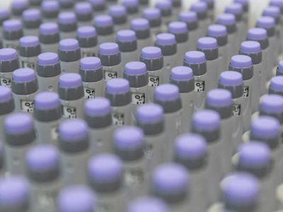 La OMS pide a las farmacéuticas un "aumento masivo de la producción" de vacunas