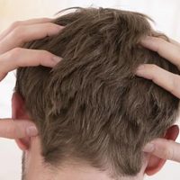 Chau a la caspa: no gastes más en productos caros y aplicá en tu cabello esta receta de la abuela que no falla