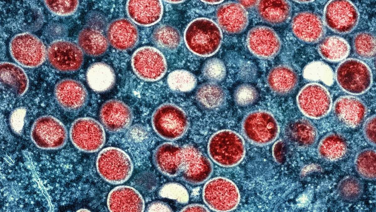 Micrografía de la viruela del mono