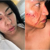 Ebrio y su familia dan golpiza a un matrimonio y a su hija de tres años tras choque vial (Video)