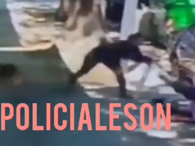Argentina: Esquizofrénica ataca a adulto mayor que le pidió levantar las heces de su perro (video)
