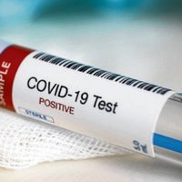 Las localidades neuquinas que cuentan con más de 100 casos activos de coronavirus