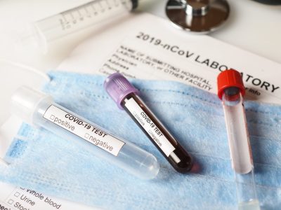 Coronavirus: Neuquén implementó tres nuevos métodos de testeo