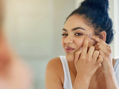 5 alimentos que te ayudan a combatir el acné y la oleosidad de la piel