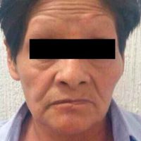 Someten a cirugías reconstructivas a menores torturados por su abuela