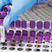 ¡Encontraron una solución para tratar el coronavirus! Continúan las investigaciones en la región