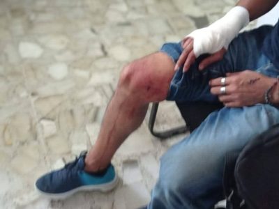 Francisco Magaña, reportero de Guerrero, sufre intento de homicidio con un arma blanca