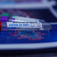 "Ataca al sistema nervioso": revelación sobre el coronavirus en Neuquén