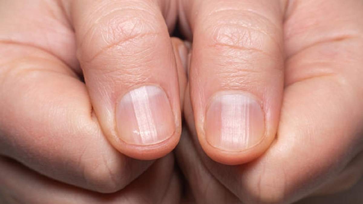 Cómo combatir las estrías de las uñas. Fuente: (X)