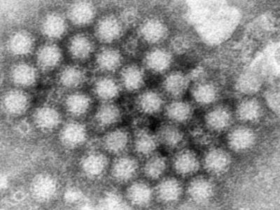 El norovirus regresa con fuerza y los casos en Estados Unidos aumentan notablemente