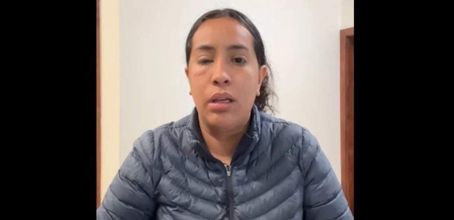 Arrojan ácido a rostro de una mujer emprendedora en Tijuana