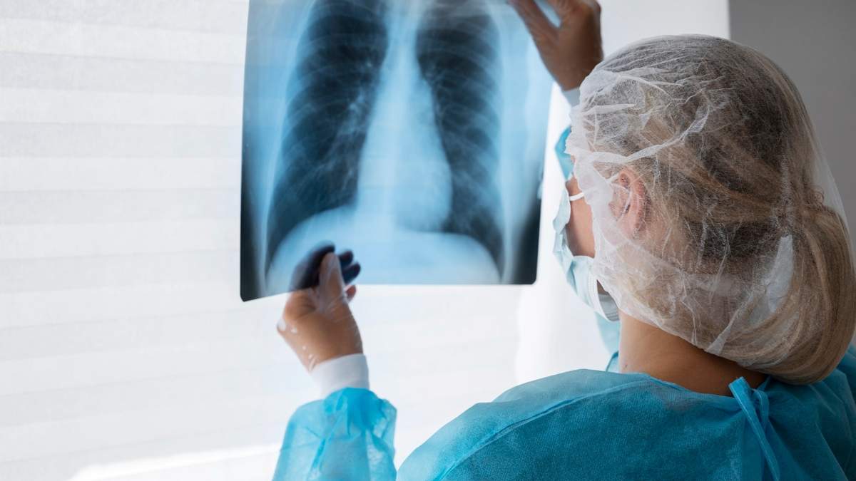Los avances terapéuticos, en especial los moduladores del CFTR, marcaron un cambio profundo en la historia natural de la fibrosis quística.