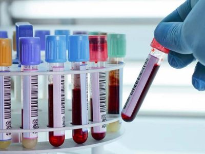 Río Negro registró 301 nuevos casos activos y 7 pacientes fallecidos por coronavirus