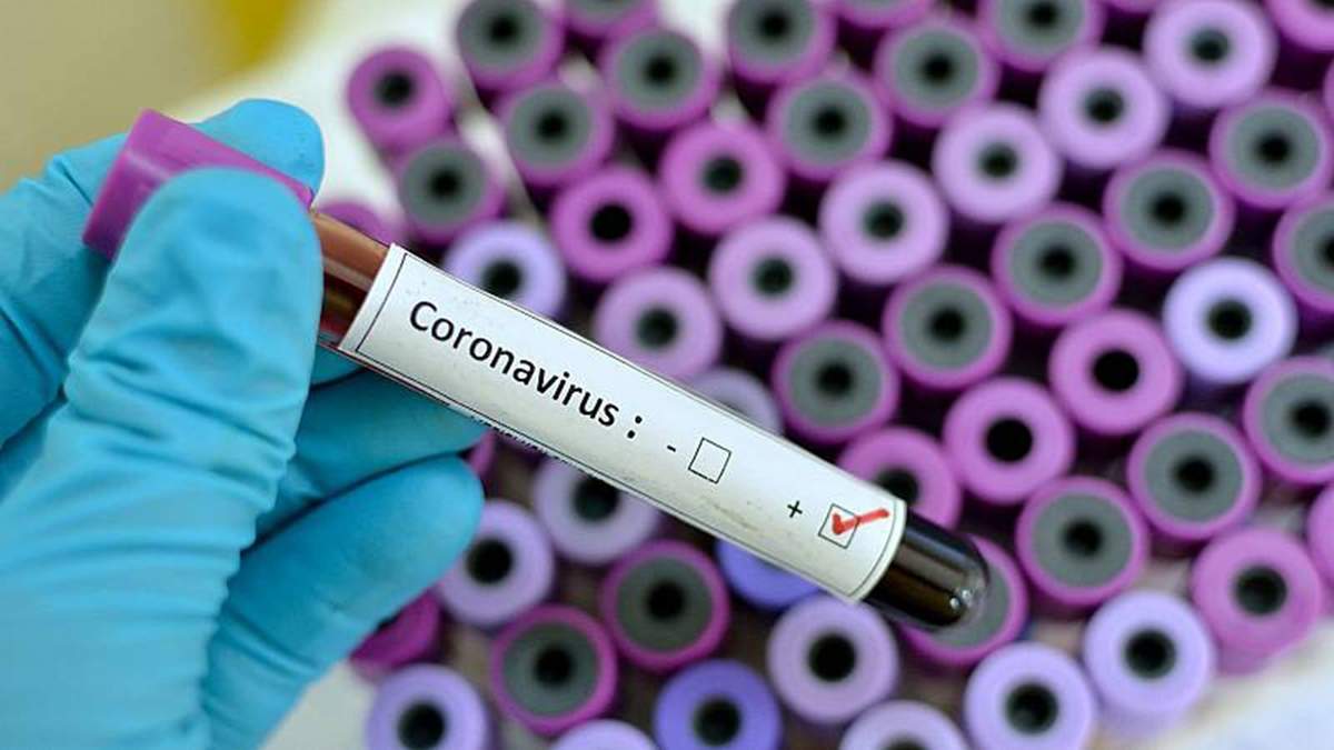 Coronavirus. Fuente: (Instagram)
