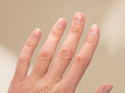 Rayas, manchas o líneas en las uñas: el detalle que muchos ignoran y dice mucho de tu salud